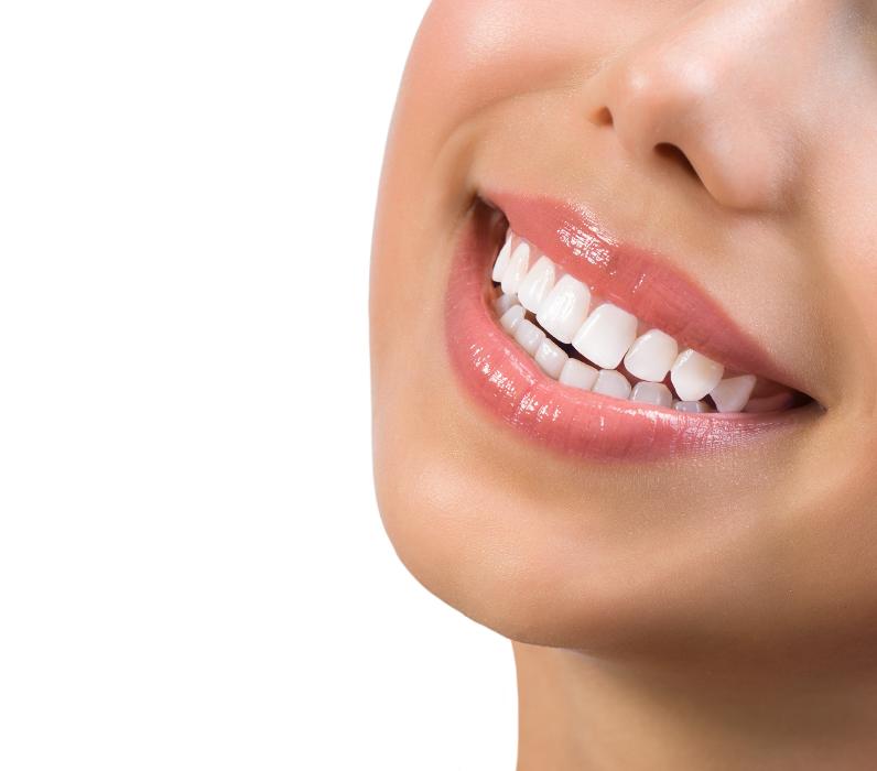 A lady smiling after teeth replacement in Oatley, NSW.