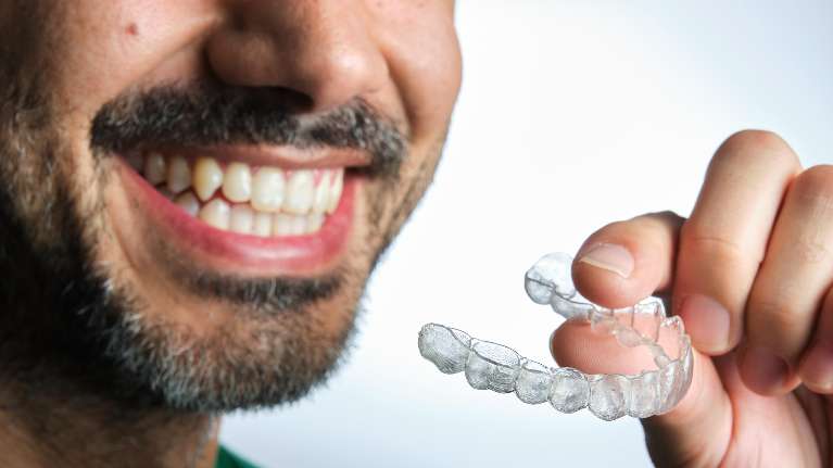Man holding Invisalign clear aligners in Oatley, NSW