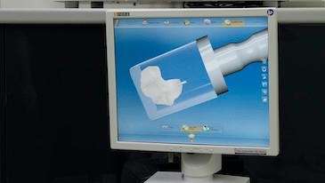 A picture of a dental crown in a computer in Oatley, NSW