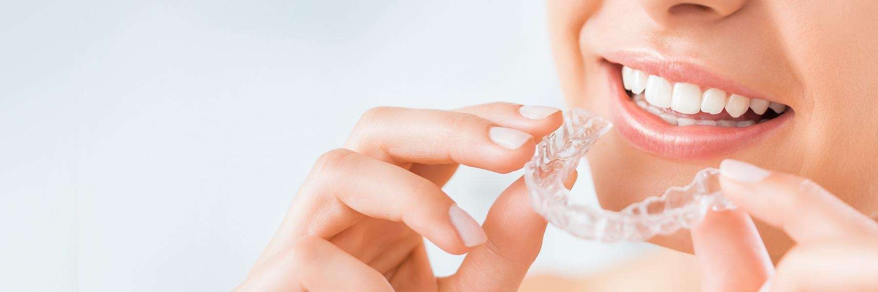 Invisalign® | Dentist