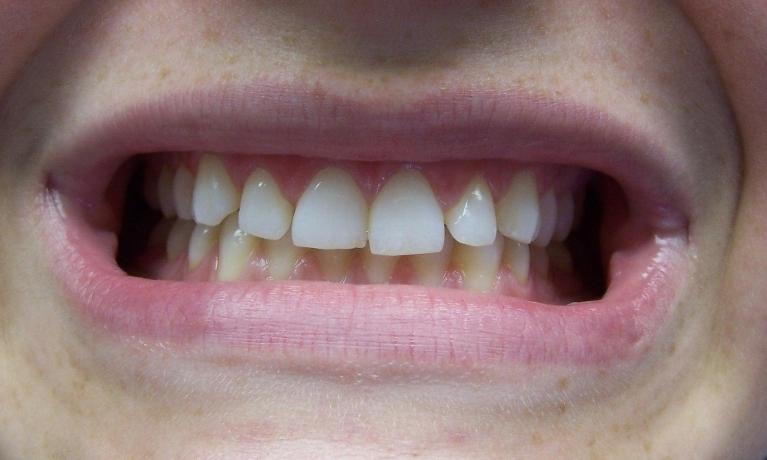 Preventative-Before-Image